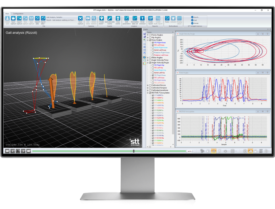 STT monitor